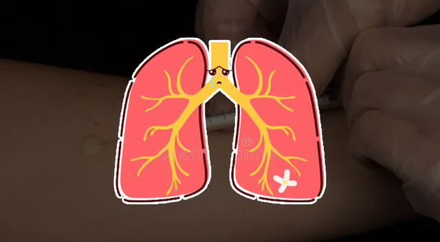 Una detección temprana de la tuberculosis puede evitar la muerte. Foto: composición GLR/difusión Una detección temprana de la tuberculosis puede evitar la muerte. Foto: composición GLR/difusión
