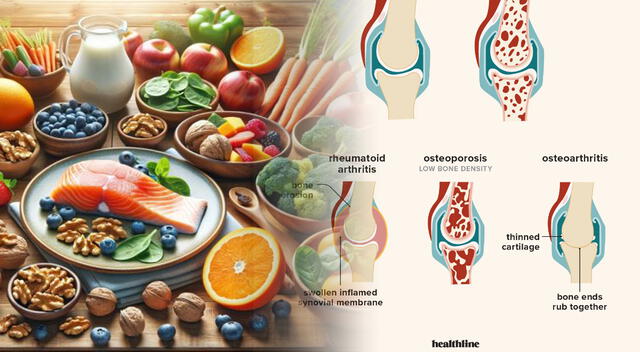 Una buena alimentación podría evitar enfermedades degenerativas. Foto: composición GLR/difusión Una buena alimentación podría evitar enfermedades degenerativas. Foto: composición GLR/difusión