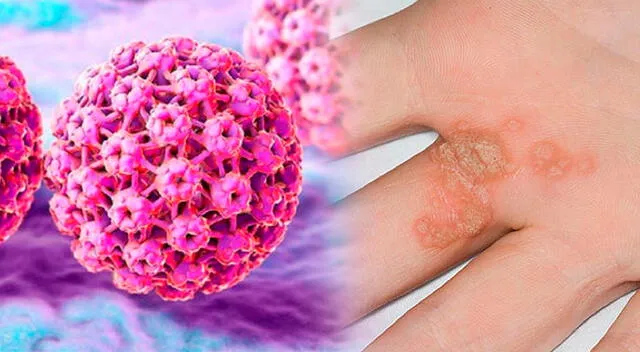 El cáncer de cuello uterino no suele presentar síntomas en sus etapas iniciales. El cáncer de cuello uterino no suele presentar síntomas en sus etapas iniciales.