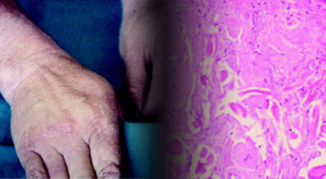 Las señales externas de una enfermedad pueden esconder un estado de salud interna más grave. Foto: composición GLR/difusión Las señales externas de una enfermedad pueden esconder un estado de salud interna más grave. Foto: composición GLR/difusión