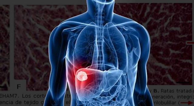Descubre cómo mejorar la salud de tu hígado. Foto: composición GLR/difusión   