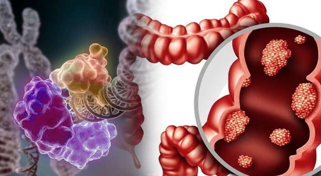 La proteína clave identificada es la p53, considerada uno de los mayores aliados del cuerpo en la prevención del cáncer de colon. La proteína clave identificada es la p53, considerada uno de los mayores aliados del cuerpo en la prevención del cáncer de colon.