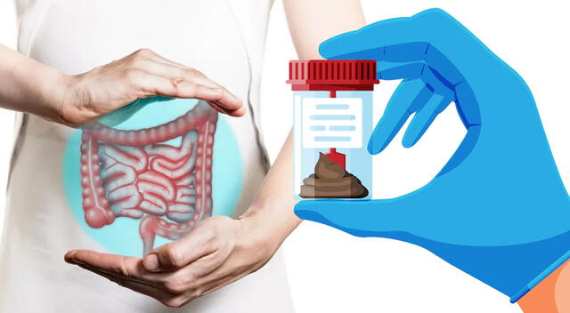 El método más eficaz y fácil de aplicar para la prevención del cáncer de colon es el test de sangre oculta en heces (SOH). El método más eficaz y fácil de aplicar para la prevención del cáncer de colon es el test de sangre oculta en heces (SOH).