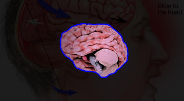 Un nuevo tratamiento revolucionaría la salud cerebral. Foto: composición GLR/difusión Un nuevo tratamiento revolucionaría la salud cerebral. Foto: composición GLR/difusión