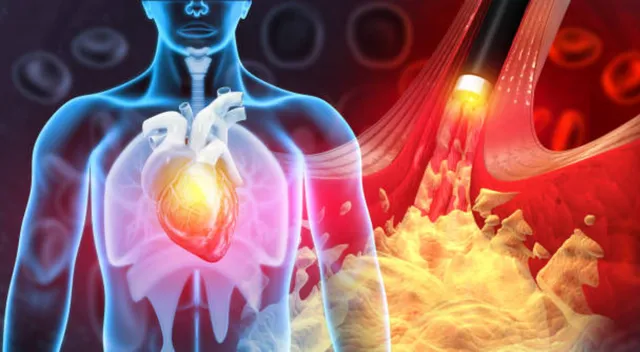 El problema surge cuando hay un exceso de colesterol en la sangre y se va directamente hasta el interior de los cardiomiocitos, las células del músculo cardíaco. El problema surge cuando hay un exceso de colesterol en la sangre y se va directamente hasta el interior de los cardiomiocitos, las células del músculo cardíaco.