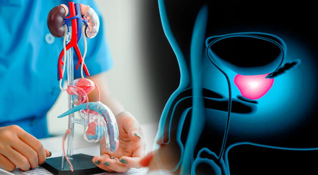 El tratamiento del cáncer de próstata ha mejorado sustancialmente en los últimos años. El tratamiento del cáncer de próstata ha mejorado sustancialmente en los últimos años.
