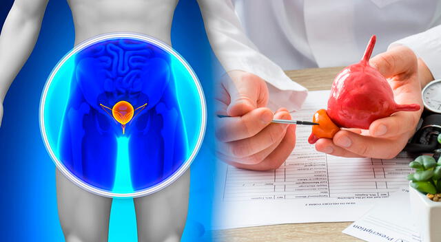 A pesar de un diagnóstico grave de cáncer de próstata, los avances recientes en el tratamiento y diagnóstico de esta enfermedad ofrecen una nueva perspectiva. A pesar de un diagnóstico grave de cáncer de próstata, los avances recientes en el tratamiento y diagnóstico de esta enfermedad ofrecen una nueva perspectiva.