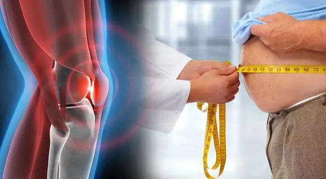Perder peso reduce significativamente el dolor de rodilla. Perder peso reduce significativamente el dolor de rodilla.