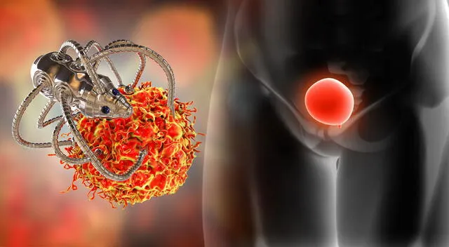 Científicos del IBEC desarrollaron nanorrobots que, al moverse por la vejiga, lograron reducir el cáncer de vejiga en un 90 % con una sola dosis en pruebas con animales. Científicos del IBEC desarrollaron nanorrobots que, al moverse por la vejiga, lograron reducir el cáncer de vejiga en un 90 % con una sola dosis en pruebas con animales.