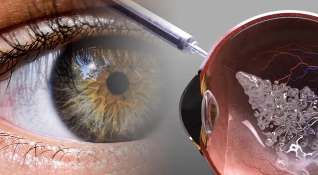 La ciencia da otro paso adelante para combatir la ceguera. Foto: composición GLR/difusión La ciencia da otro paso adelante para combatir la ceguera. Foto: composición GLR/difusión