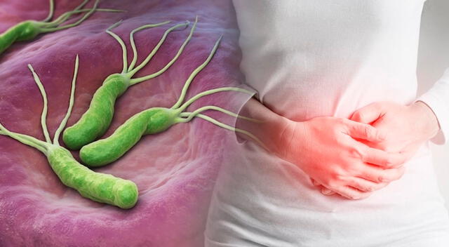 Para eliminar la Helicobacter pylori es necesario tomar antibióticos. Para eliminar la Helicobacter pylori es necesario tomar antibióticos.