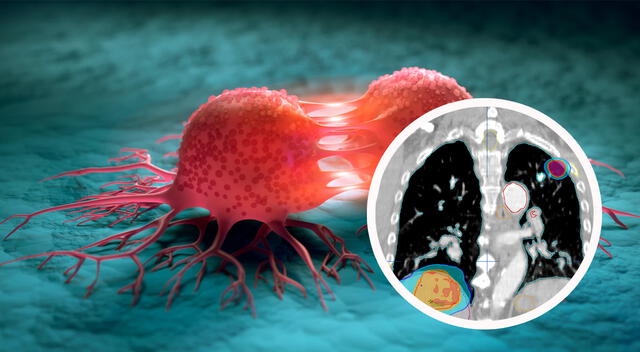 La transición endotelial inducida por el tumor facilita la entrada de los clústeres cancerosos. La transición endotelial inducida por el tumor facilita la entrada de los clústeres cancerosos.