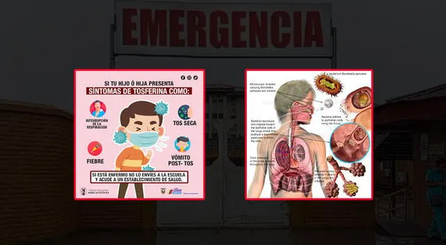 Los medicamentos contra la tos ferina ayudan a reducir la duración de la enfermedad. Foto: composición GLR/difusión Los medicamentos contra la tos ferina ayudan a reducir la duración de la enfermedad. Foto: composición GLR/difusión