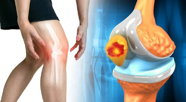 Los especialistas advierten que uno de los primeros signos del osteosarcoma es un dolor persistente en los huesos o las articulaciones. Los especialistas advierten que uno de los primeros signos del osteosarcoma es un dolor persistente en los huesos o las articulaciones.