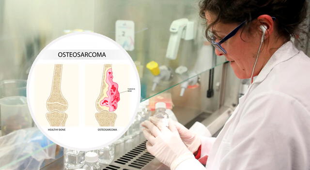 La investigación permite entender cómo evoluciona este tumor y abre nuevas vías de tratamiento.