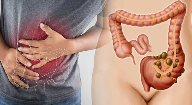 Con la práctica del ayuno intermitente, puedes lograr una limpieza de colon efectiva. Con la práctica del ayuno intermitente, puedes lograr una limpieza de colon efectiva.