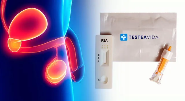 El dispositivo 'Testeavida' ofrece una detección rápida y precisa del cáncer de próstata mediante una simple muestra de orina. El dispositivo 'Testeavida' ofrece una detección rápida y precisa del cáncer de próstata mediante una simple muestra de orina.