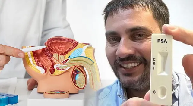 La prueba casera, desarrollada en España, permite identificar riesgos de cáncer de próstata en solo 15 minutos. La prueba casera, desarrollada en España, permite identificar riesgos de cáncer de próstata en solo 15 minutos.