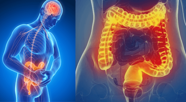 Los desequilibrios en la microbiota intestinal pueden provocar síntomas digestivos, emocionales y cutáneos. Los desequilibrios en la microbiota intestinal pueden provocar síntomas digestivos, emocionales y cutáneos.