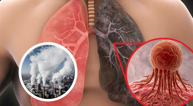 Las partículas finas presentes en el aire de las grandes ciudades representan un riesgo creciente para la salud pulmonar, incluso en personas no fumadoras. Las partículas finas presentes en el aire de las grandes ciudades representan un riesgo creciente para la salud pulmonar, incluso en personas no fumadoras.