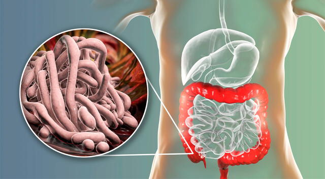 La prevención, como el lavado de manos, es clave para evitar infecciones parasitarias. La prevención, como el lavado de manos, es clave para evitar infecciones parasitarias.