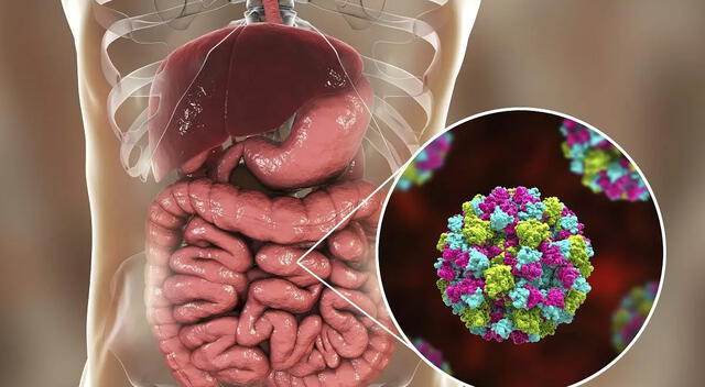 La prevención de la gastroenteritis incluye buena higiene y cuidado en la preparación de los alimentos. La prevención de la gastroenteritis incluye buena higiene y cuidado en la preparación de los alimentos.