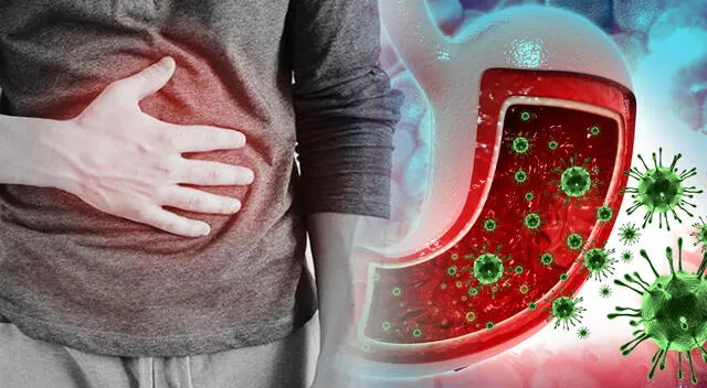 La gastroenteritis puede afectar a personas de todas las edades y requiere atención si hay síntomas graves. La gastroenteritis puede afectar a personas de todas las edades y requiere atención si hay síntomas graves.