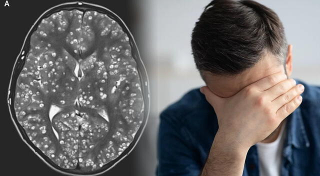 Los especialistas alertan que las migrañas pueden ser síntomas secundarios de otras enfermedades más complejas. Los especialistas alertan que las migrañas pueden ser síntomas secundarios de otras enfermedades más complejas.