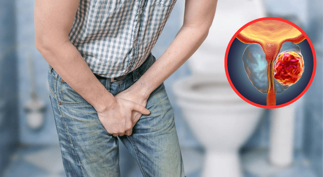 Uno de los desarrollos más prometedores es la darolutamida, una molécula que ha revolucionado el abordaje del cáncer de próstata metastásico y resistente a la castración. Uno de los desarrollos más prometedores es la darolutamida, una molécula que ha revolucionado el abordaje del cáncer de próstata metastásico y resistente a la castración.