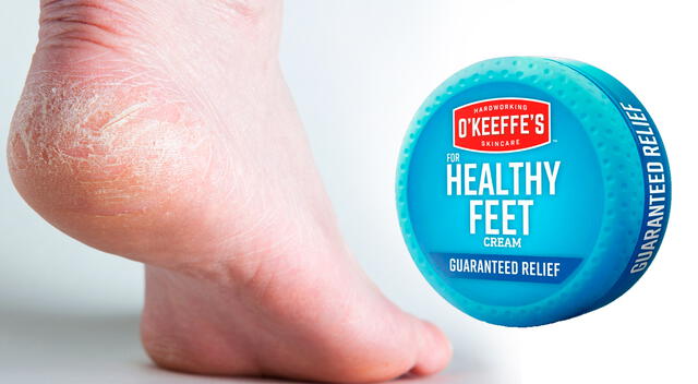 La eficacia de esta crema para pies agrietados se debe a su alta concentración de ingredientes humectantes. La eficacia de esta crema para pies agrietados se debe a su alta concentración de ingredientes humectantes.