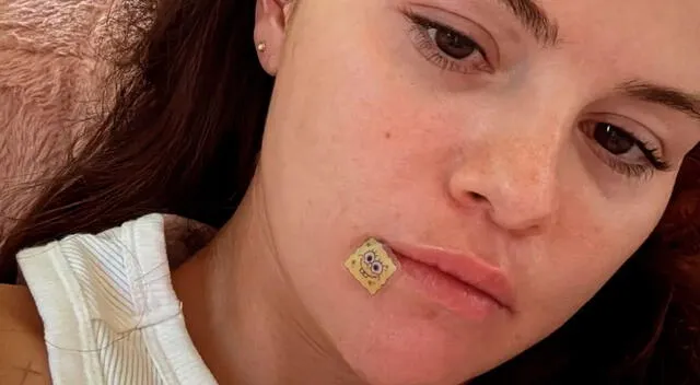 Selena Gomez compartió el método que la ayudó a combatir el acné de manera efectiva. Selena Gomez compartió el método que la ayudó a combatir el acné de manera efectiva.
