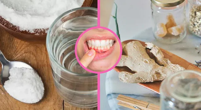 Remedios caseros para la sensibilidad dental. Remedios caseros para la sensibilidad dental.