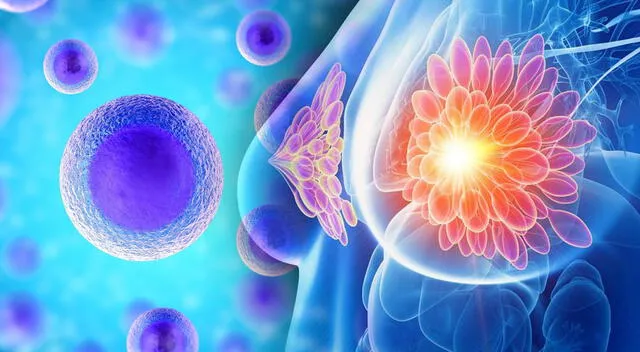 Investigadores españoles identificaron una proteína clave en la metástasis del cáncer de mama, abriendo nuevas posibilidades para su tratamiento. Investigadores españoles identificaron una proteína clave en la metástasis del cáncer de mama, abriendo nuevas posibilidades para su tratamiento.