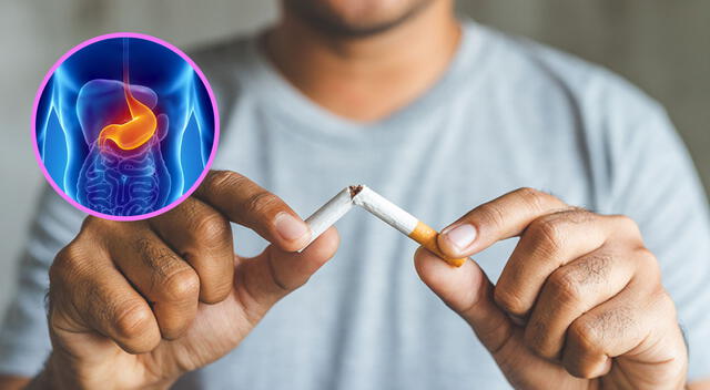Fumar duplica el riesgo de padecer de cáncer de estómago Fumar duplica el riesgo de padecer de cáncer de estómago