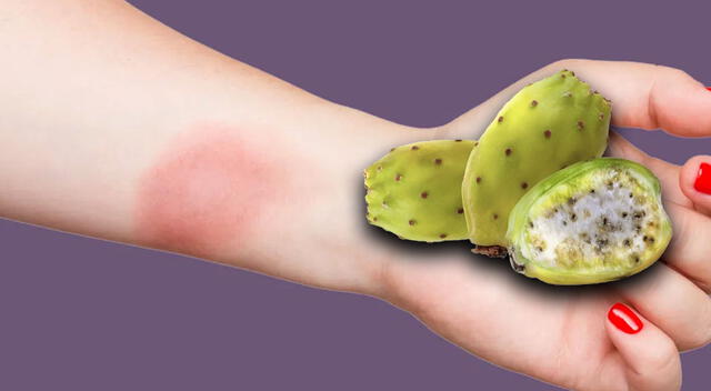 La cáscara de tuna alivia irritaciones como heridas o quemaduras leves. La cáscara de tuna alivia irritaciones como heridas o quemaduras leves.