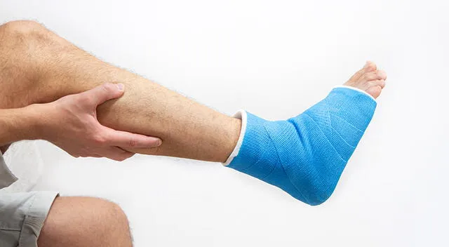 Ante un esguince de tobillo es recomendable acudir a un médico. Ante un esguince de tobillo es recomendable acudir a un médico.