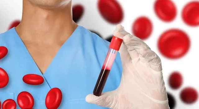 El camu camu es un alimento que batalla contra la anemia. El camu camu es un alimento que batalla contra la anemia.