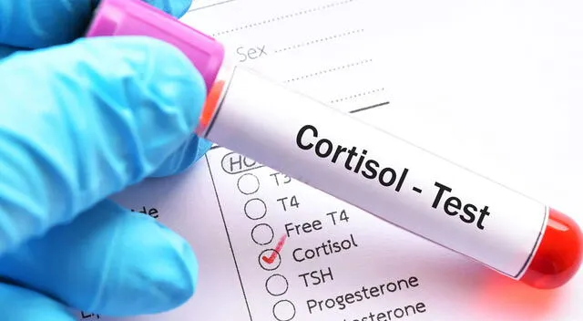Cortisol Cortisol