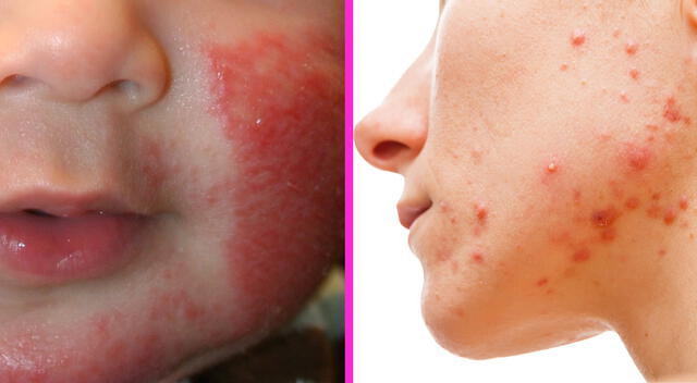 Condiciones dermatológicas. Condiciones dermatológicas.