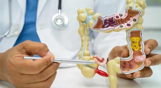 La apendicitis La apendicitis