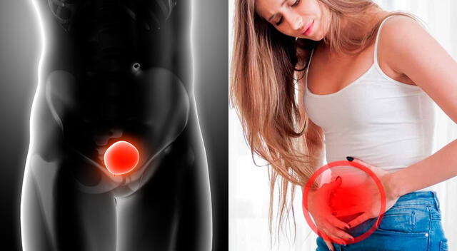 Cuidar la salud urinaria es clave para prevenir infecciones y mantener el bienestar diario. Cuidar la salud urinaria es clave para prevenir infecciones y mantener el bienestar diario.