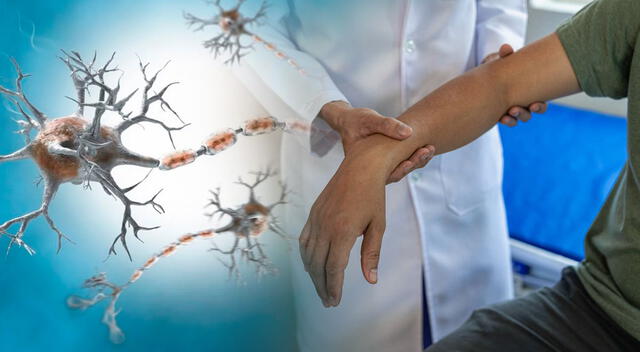 El síndrome de Guillain-Barré puede afectar los nervios periféricos, generando debilidad muscular y problemas respiratorios en casos graves. El síndrome de Guillain-Barré puede afectar los nervios periféricos, generando debilidad muscular y problemas respiratorios en casos graves.