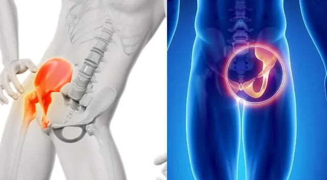 El tratamiento de la pubalgia requiere reposo, terapias de rehabilitación y, en casos graves, intervención quirúrgica. El tratamiento de la pubalgia requiere reposo, terapias de rehabilitación y, en casos graves, intervención quirúrgica.