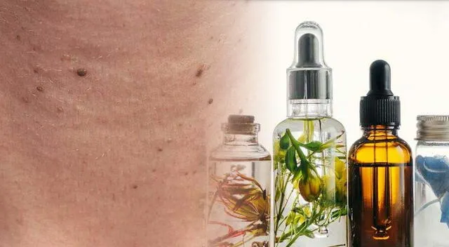 Tratamientos médicos como la crioterapia o la electrocauterización permiten eliminar las verrugas del cuello de forma segura y eficaz. Tratamientos médicos como la crioterapia o la electrocauterización permiten eliminar las verrugas del cuello de forma segura y eficaz.
