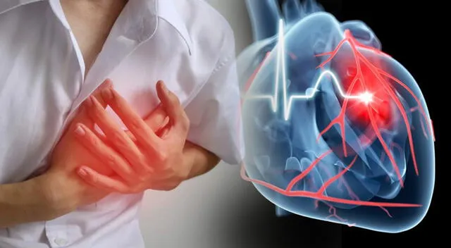 Los expertos señalan que la principal causa de la miocarditis son las infecciones virales. Los expertos señalan que la principal causa de la miocarditis son las infecciones virales.