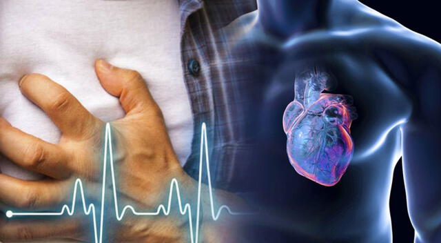 La miocarditis puede originarse por reacciones a ciertos medicamentos, drogas ilegales, sustancias químicas o radiación. La miocarditis puede originarse por reacciones a ciertos medicamentos, drogas ilegales, sustancias químicas o radiación.