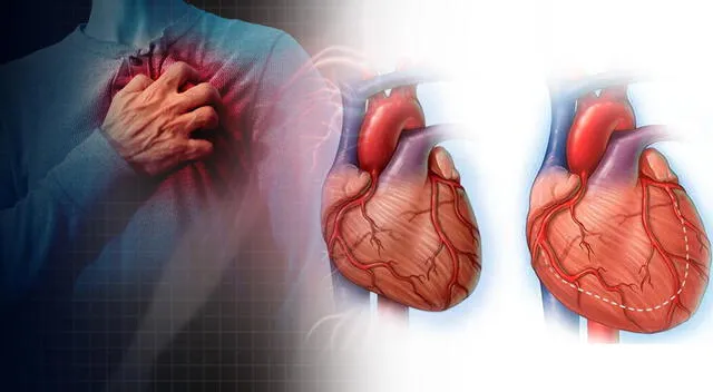 La miocarditis es la inflamación del miocardio, el músculo encargado de bombear la sangre a todo el cuerpo. La miocarditis es la inflamación del miocardio, el músculo encargado de bombear la sangre a todo el cuerpo.