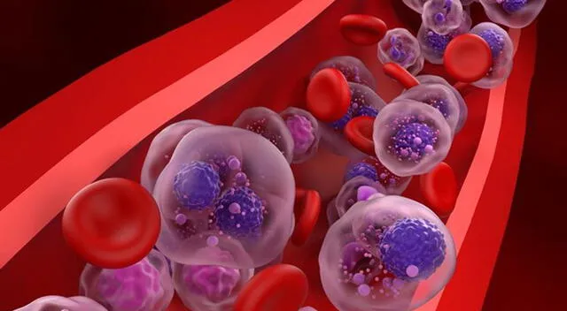 Los avances en terapias como células CAR-T y anticuerpos biespecíficos abren nuevas esperanzas para pacientes con mieloma múltiple refractario. Los avances en terapias como células CAR-T y anticuerpos biespecíficos abren nuevas esperanzas para pacientes con mieloma múltiple refractario.