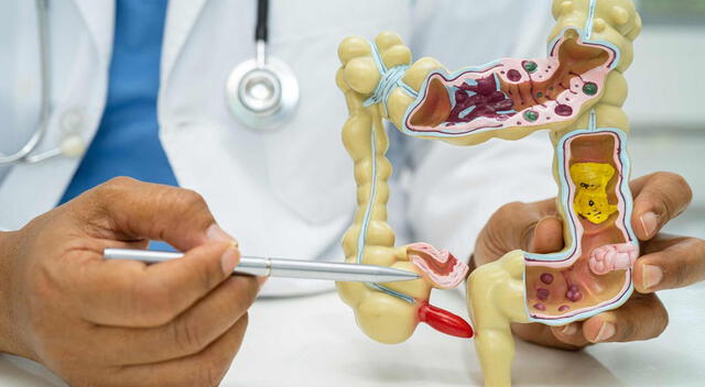 La ciencia ha descubierto que el apéndice alberga una microbiota única, esencial para mantener el equilibrio intestinal. La ciencia ha descubierto que el apéndice alberga una microbiota única, esencial para mantener el equilibrio intestinal.