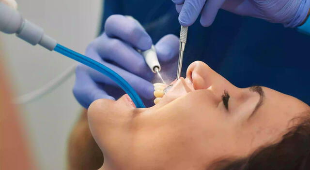 Limpieza dental